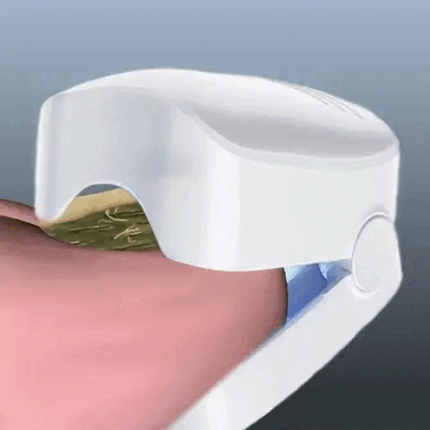 Lumière Bleue Anti-Mycose